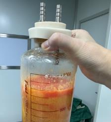 日土水动力吸脂手术要做多久？